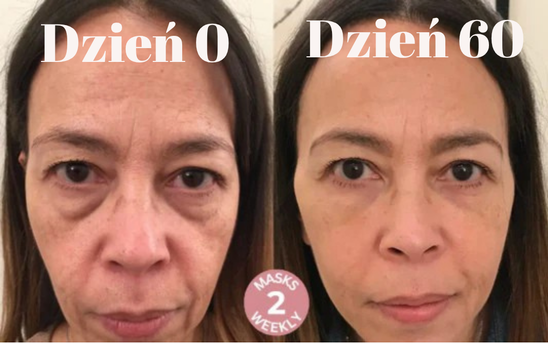 Maski liftingujące Elise (12 szt.)