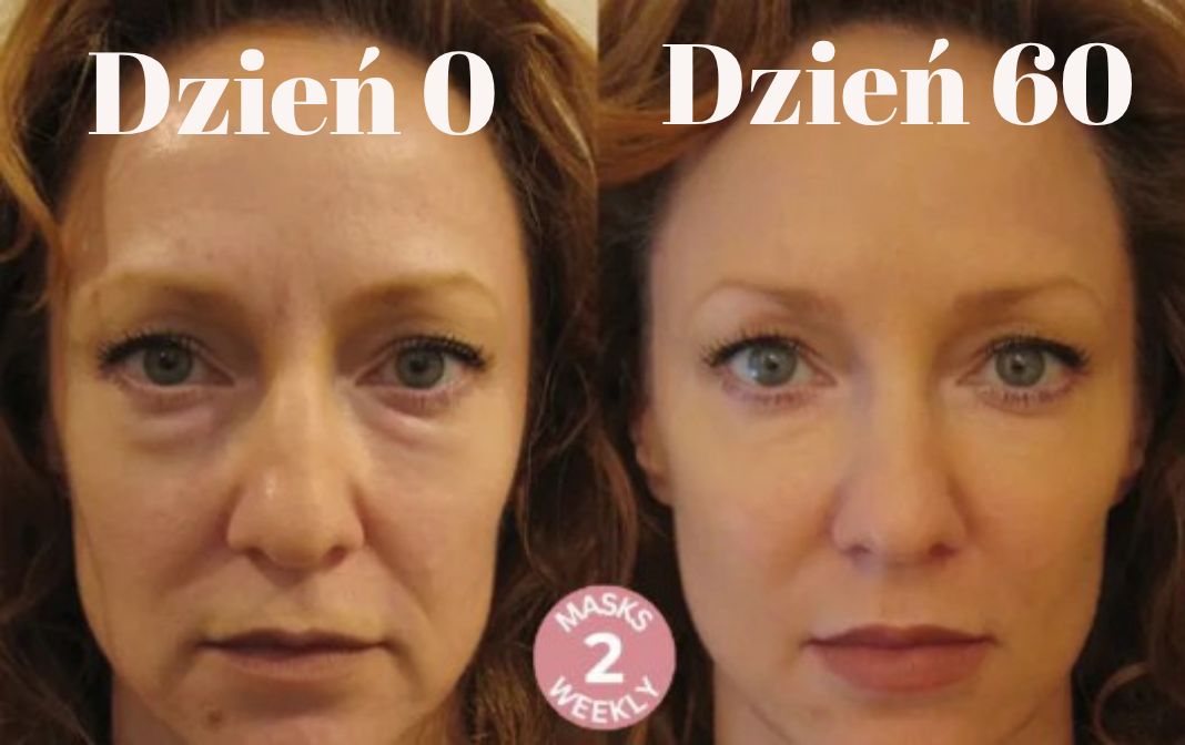 Maski liftingujące Elise (12 szt.)